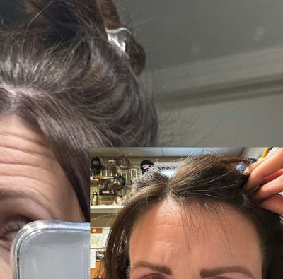completely stopped by hair from falling out