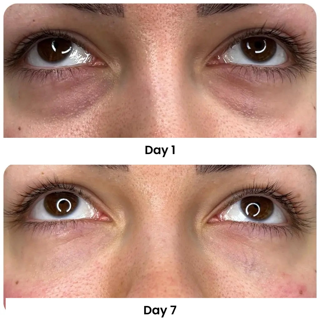 Medicube Mix & Match Eye Serum Set – Brightening & Puffiness Care