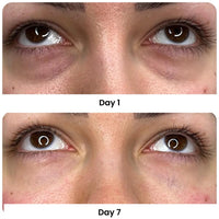 Medicube Mix & Match Eye Serum Set – Brightening & Puffiness Care