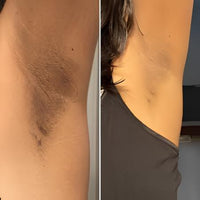Body Glow Routine for Breakouts, Texture & Dark Marks™