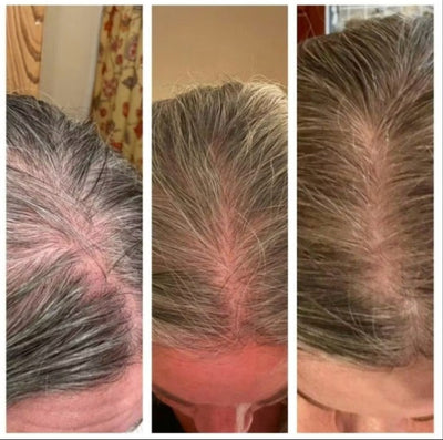 I was losing a lot of hair due to menopause and it had become really thin and wispy