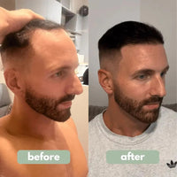 Be BodyWise - Hair Growth Serum™