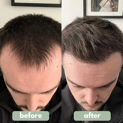 Be BodyWise - Hair Growth Serum™